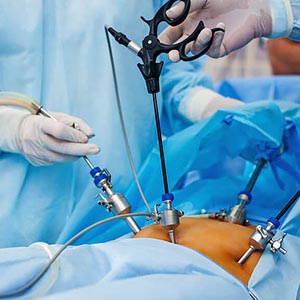 Pediatric Laparoscopic surgery in pune